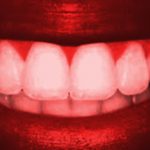 Фото: отбеливание зубов Opalescence в Перми по низким ценам. Самое лучшее отбеливание зубов в стоматологической клинике София-Дента. Эффективно в домашних условиях. Чистка зубов, удаление зубного налета, лечение зубов 24 часа круглосуточно.