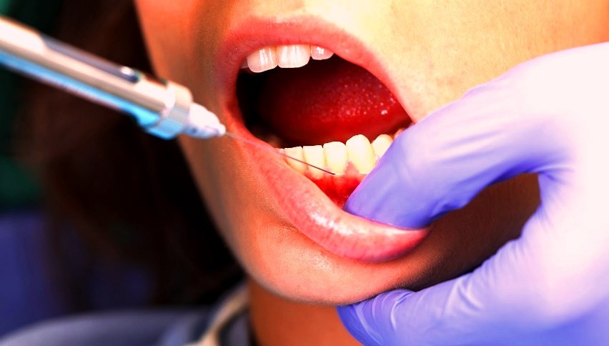 Обезболивание при протезировании зубов в Перми
