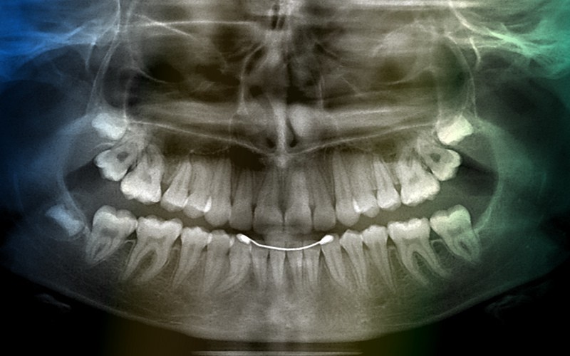 Рентген зубов в Перми